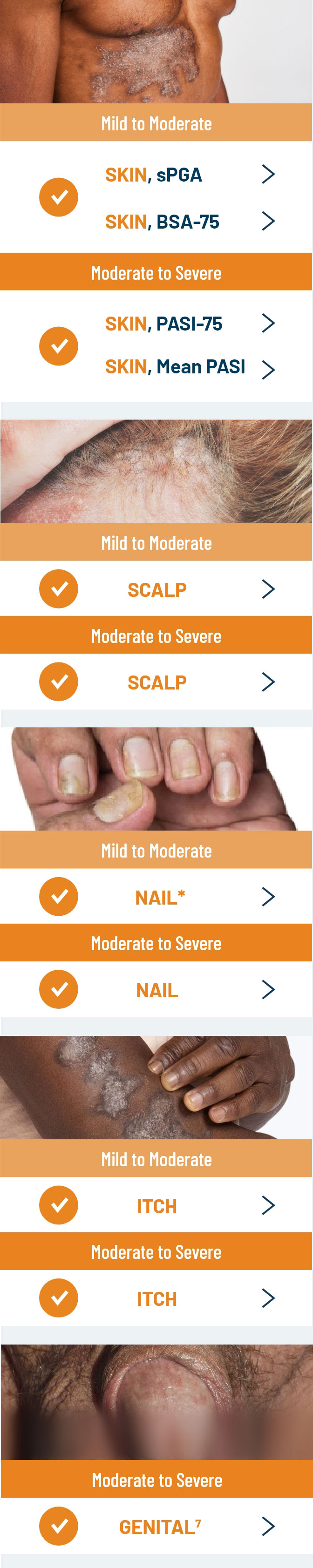 Chart of Otezla indicated to treat multiple manifestations, from mild to moderate and moderate to severe plaque psoriasis