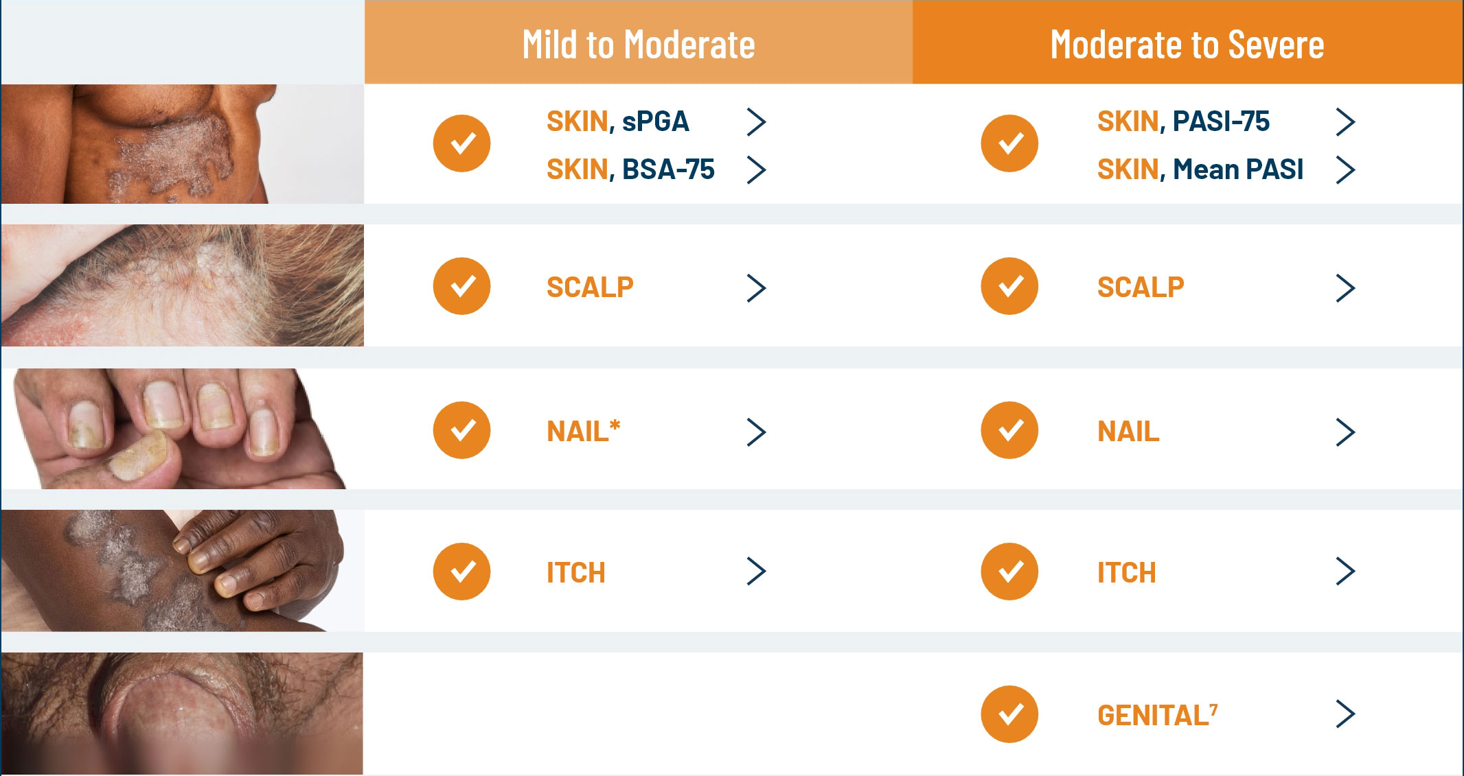 Chart of Otezla indicated to treat multiple manifestations, from mild to moderate and moderate to severe plaque psoriasis