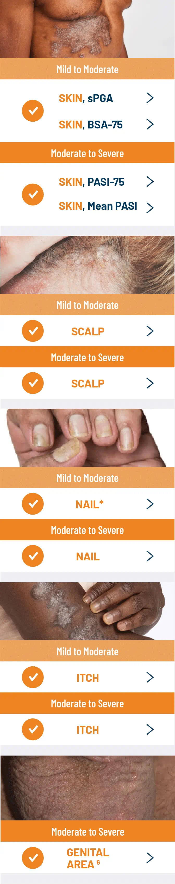 Otezla® (apremilast) is indicated to treat mild to moderate, and moderate to
severe plaque psoriasis PsO